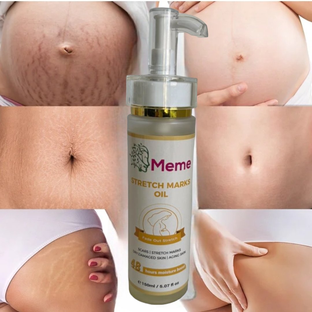 STRETCH MARK OIL - Meme Beauty Depot